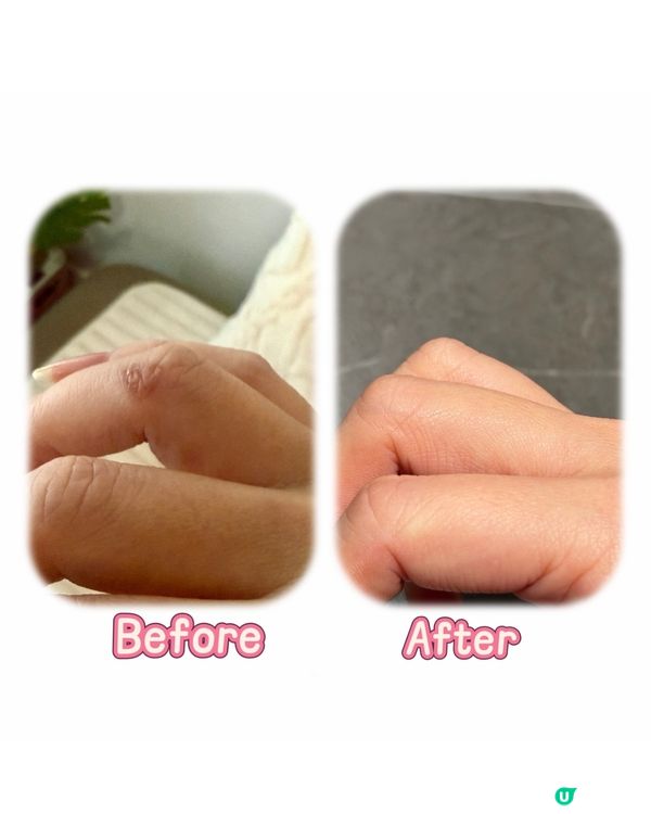 Oronine H 娥羅納英 H 軟膏