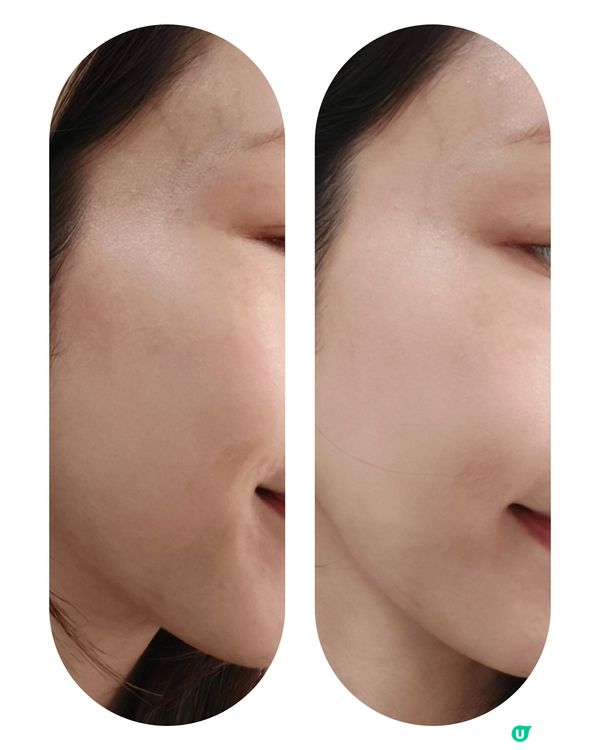 敏感肌都適用嘅「早C晩A」！