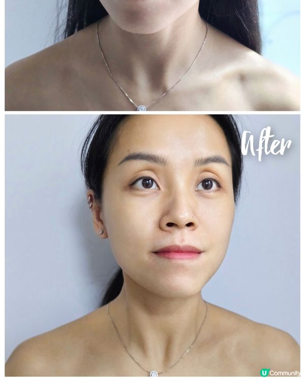 靚膊變仙女 ✨ 肩頸告別虎背熊腰 💪