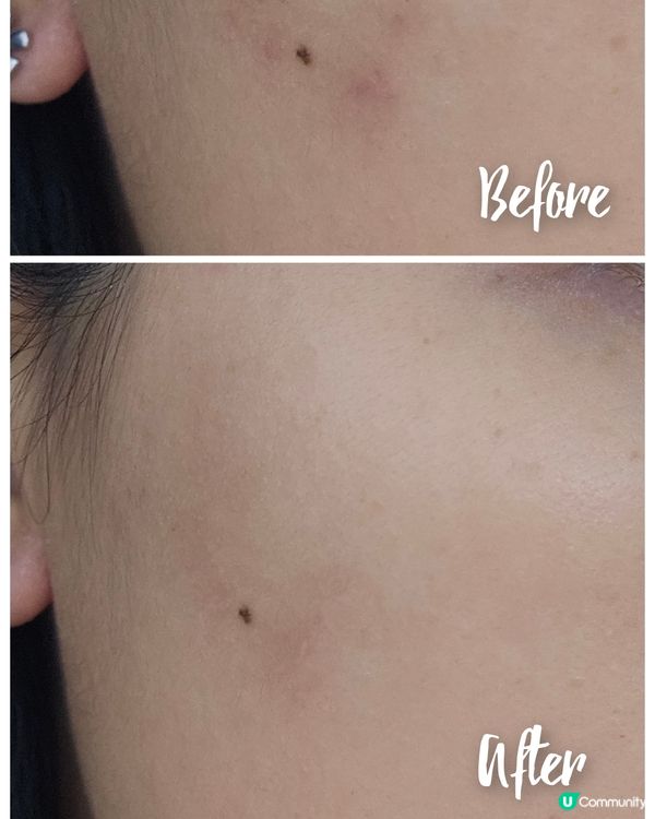 靚膊變仙女 ✨ 肩頸告別虎背熊腰 💪