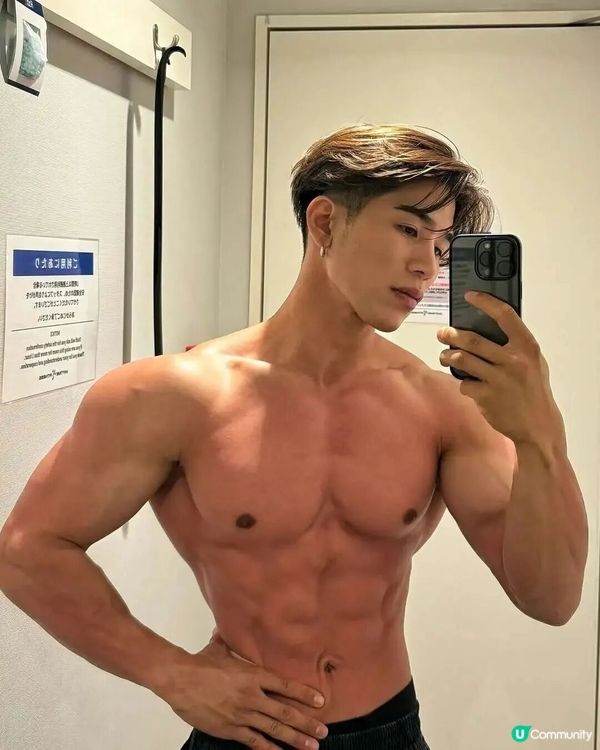 33歲日本男曾被笑似「猩猩」🦍整容後靚仔到似明星😱豪砸百萬円後出街都會被搭訕⁉️