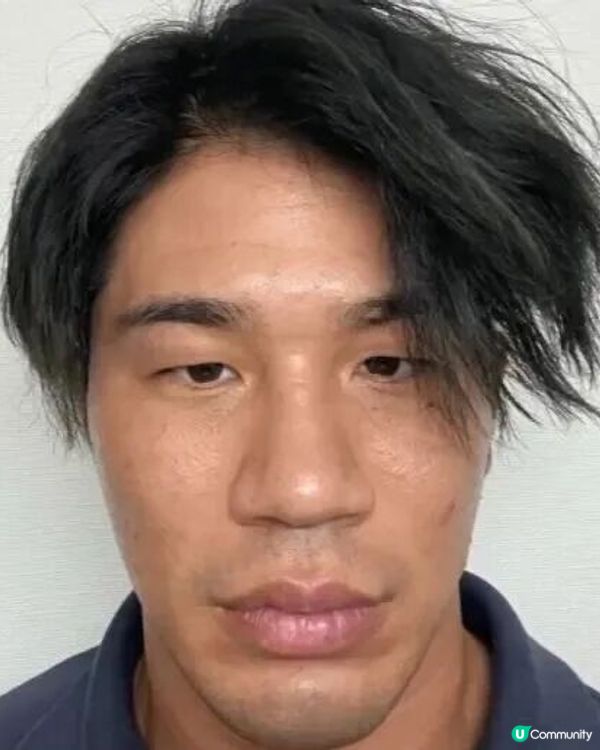 33歲日本男曾被笑似「猩猩」🦍整容後靚仔到似明星😱豪砸百萬円後出街都會被搭訕⁉️