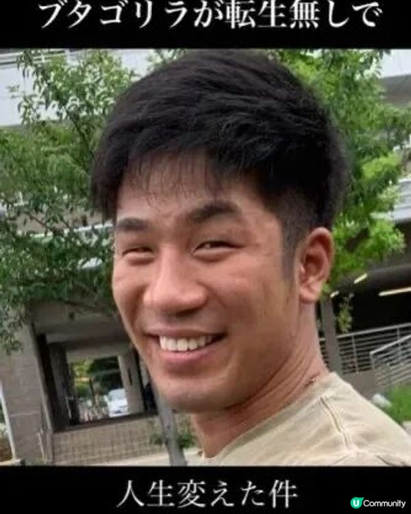 33歲日本男曾被笑似「猩猩」🦍整容後靚仔到似明星😱豪砸百萬円後出街都會被搭訕⁉️