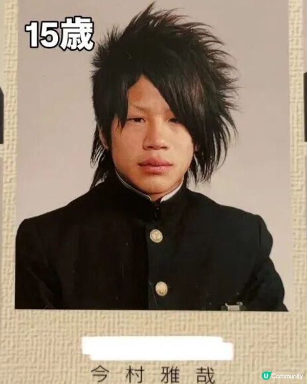 33歲日本男曾被笑似「猩猩」🦍整容後靚仔到似明星😱豪砸百萬円後出街都會被搭訕⁉️