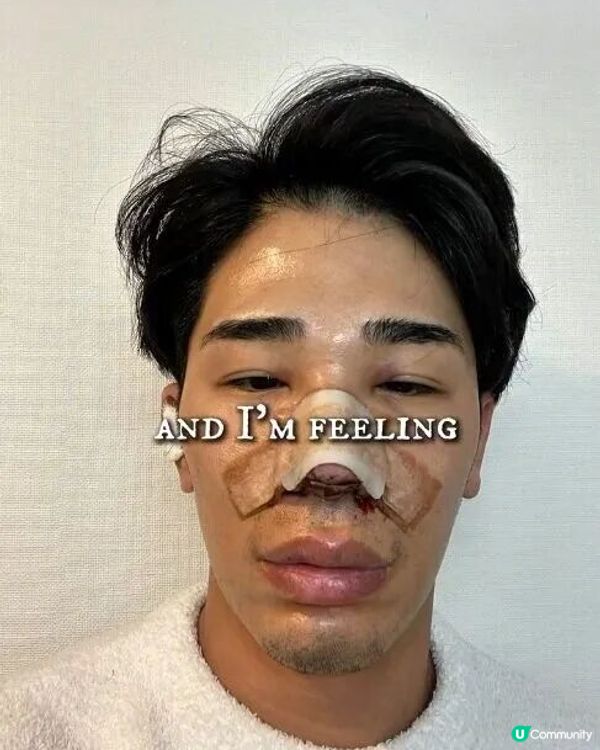 33歲日本男曾被笑似「猩猩」🦍整容後靚仔到似明星😱豪砸百萬円後出街都會被搭訕⁉️