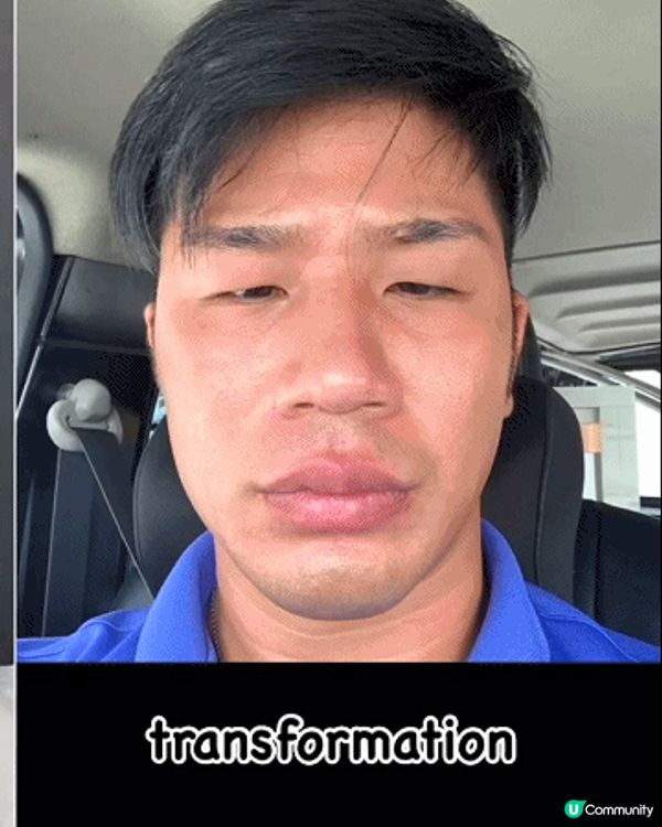 33歲日本男曾被笑似「猩猩」🦍整容後靚仔到似明星😱豪砸百萬円後出街都會被搭訕⁉️