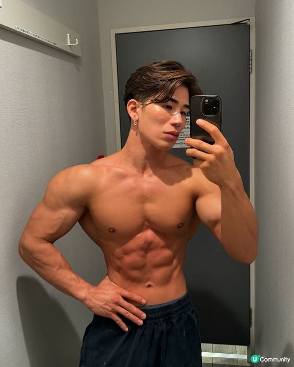 33歲日本男曾被笑似「猩猩」🦍整容後靚仔到似明星😱豪砸百萬円後出街都會被搭訕⁉️