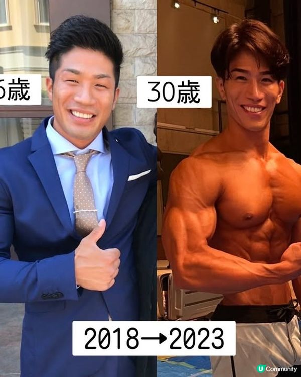 33歲日本男曾被笑似「猩猩」🦍整容後靚仔到似明星😱豪砸百萬円後出街都會被搭訕⁉️