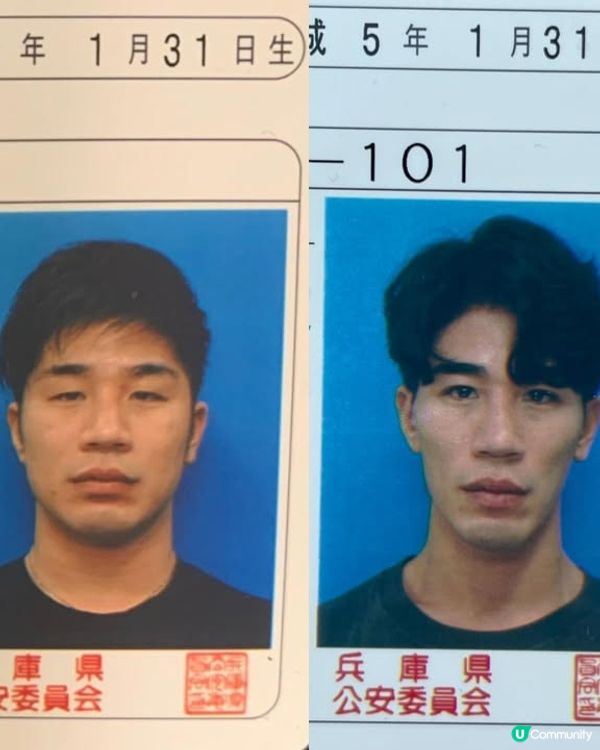 33歲日本男曾被笑似「猩猩」🦍整容後靚仔到似明星😱豪砸百萬円後出街都會被搭訕⁉️