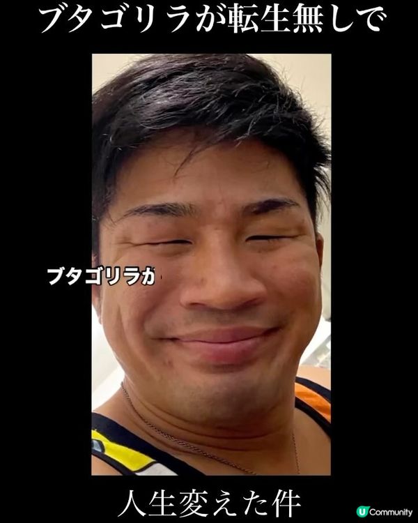 33歲日本男曾被笑似「猩猩」🦍整容後靚仔到似明星😱豪砸百萬円後出街都會被搭訕⁉️