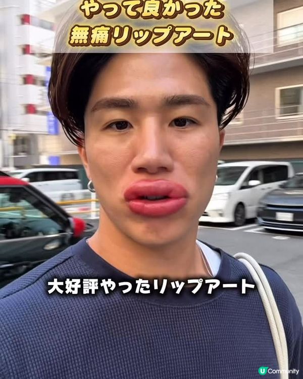 33歲日本男曾被笑似「猩猩」🦍整容後靚仔到似明星😱豪砸百萬円後出街都會被搭訕⁉️