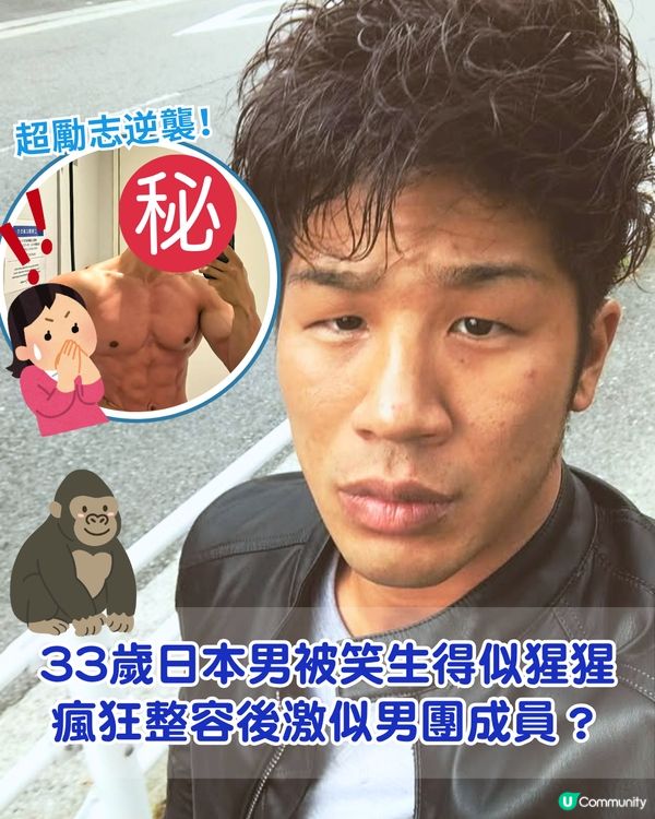 33歲日本男曾被笑似「猩猩」🦍整容後靚仔到似明星😱豪砸百萬円後出街都會被搭訕⁉️