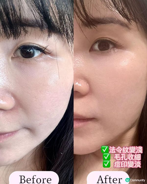🧏🏻‍♀️懶人恩物 x CurrentBody Skin LED Multi Light 光療面膜儀💛