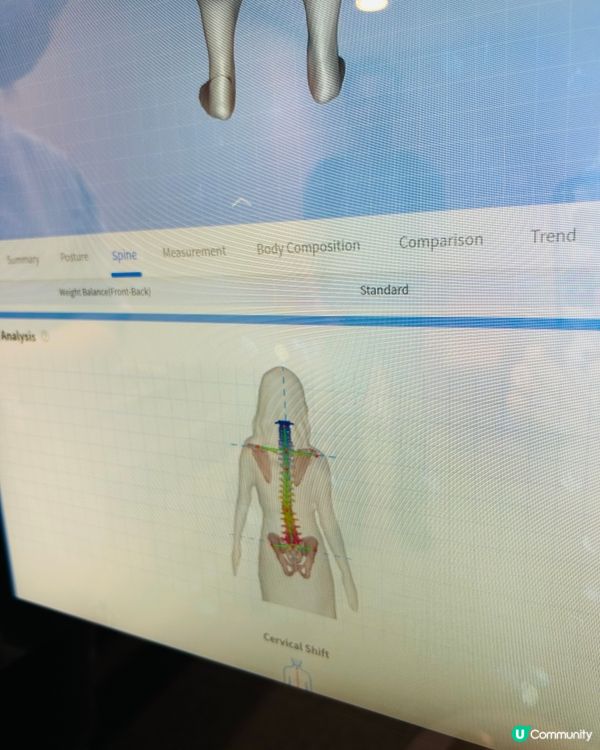 側彎救星！告別頸痛頭暈