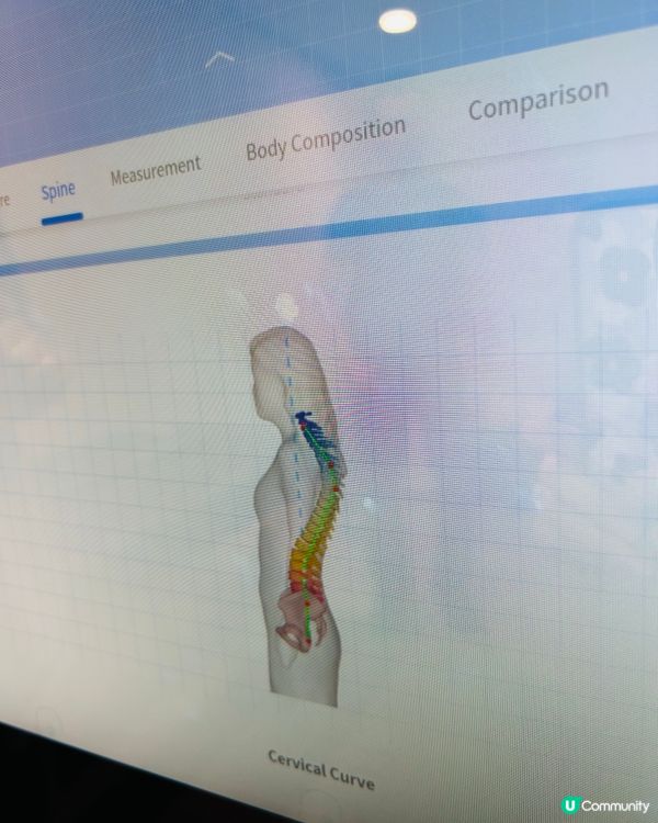 側彎救星！告別頸痛頭暈