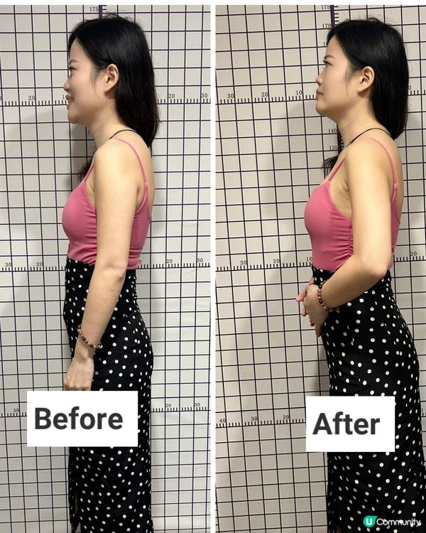 側彎救星！告別頸痛頭暈