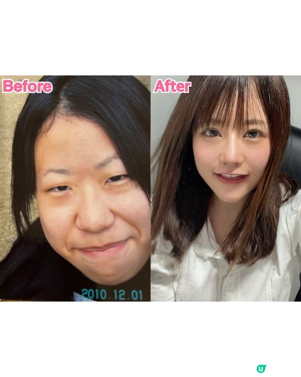 日女因生得醜自細遭嘲笑欺凌😢狂砸400萬變「有村架純」❗️仲開埋公司做CEO👩🏻‍💼