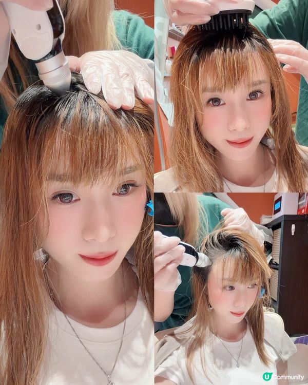 頭皮 SOS 告別煩惱！✨💆‍♀️