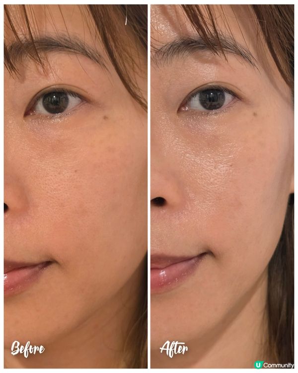 光療面膜儀✨ 1個月嫩肌進化！🤩