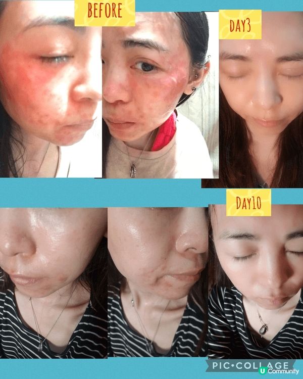 這款產品是理膚泉(La Roche-Posay) 的CICA...