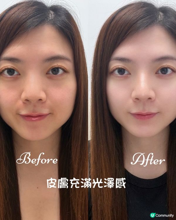 愛完全醫學系列麥角硫因水光針