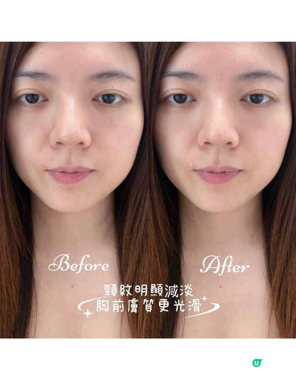 CurrentBody Skin 第二代光療胸頸美容儀
