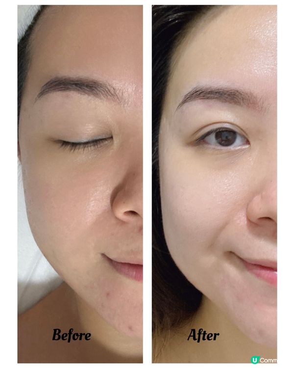 Cule Peel 煥膚新體驗！✨