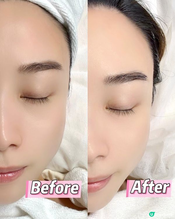 $198 變靚臉 ✨🤣