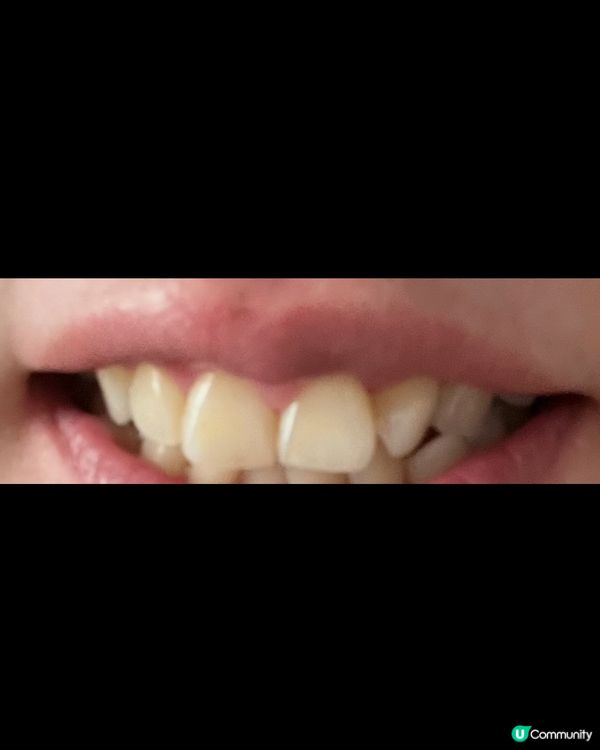 Hits Different 人氣美白牙膏