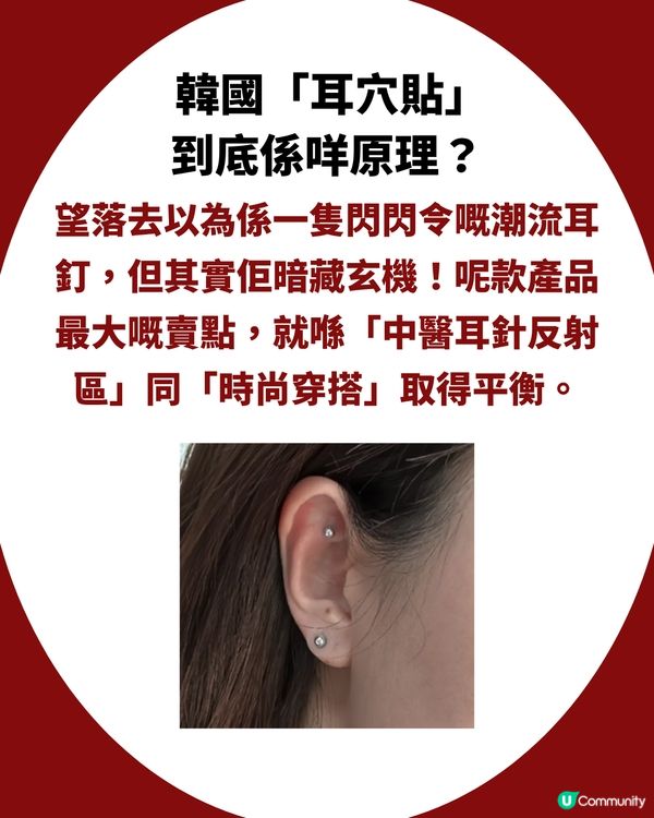 韓國爆紅「耳穴貼」極速去水腫＋消包包面！貼住返工冇人知？網民：真係好神奇！🤯