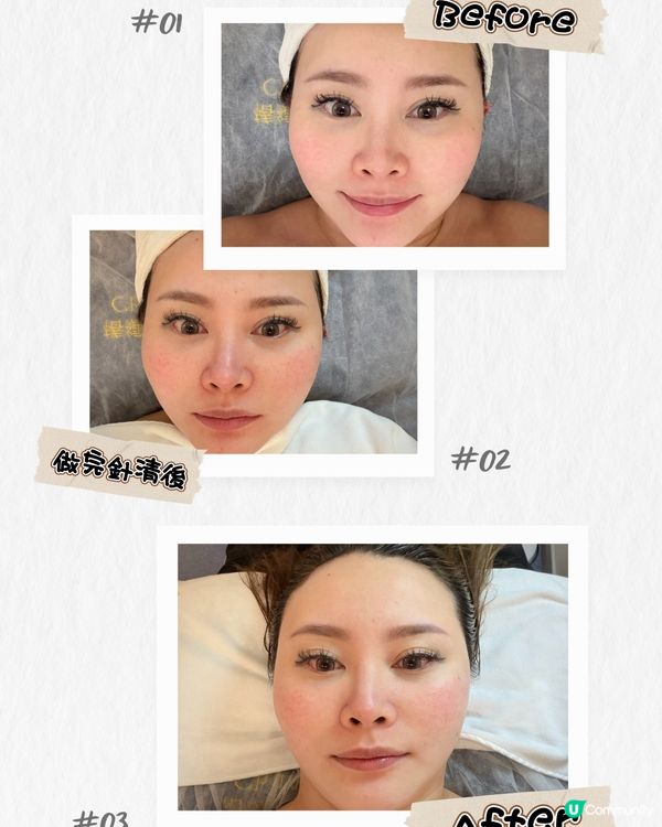 細胞機✨Facial超緊致💆🏻‍♀️！