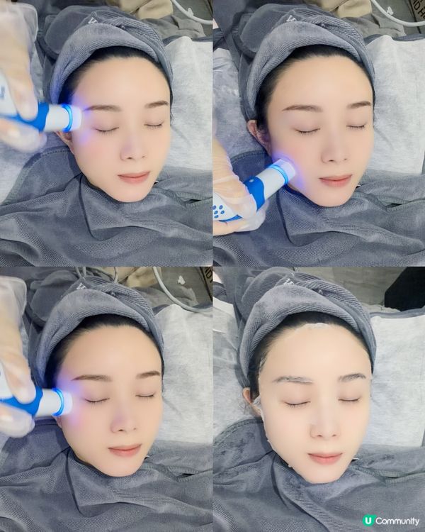 ✨【旺角窩心小店facial】打造細滑水潤肌💎