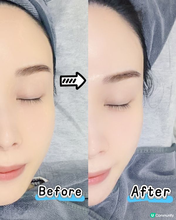 ✨【旺角窩心小店facial】打造細滑水潤肌💎