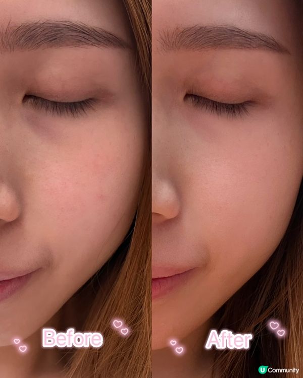 無時間去美容院？光療面膜儀搞掂！✨