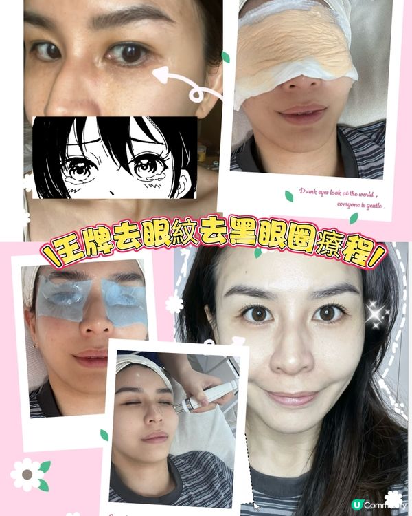 黑眼圈救星