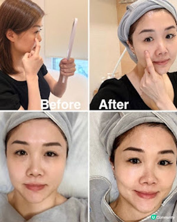 全面解決我嘅初老眼周問題 @eye refine