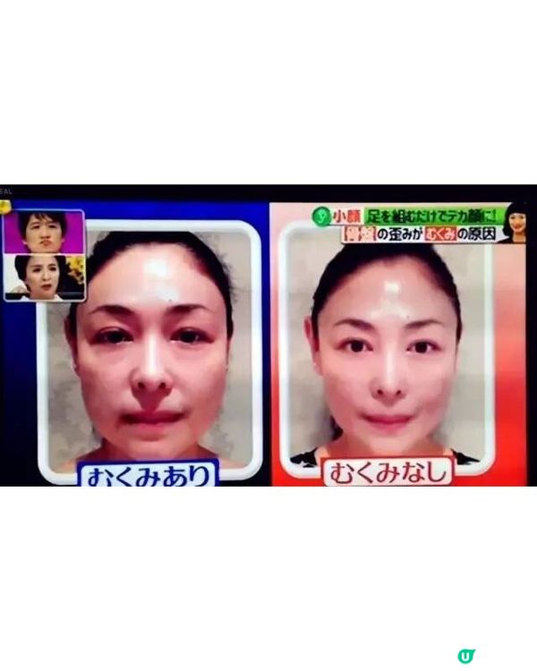🚨日本節目揭3大變醜日常惡習！「1動作」會加深眼紋黑眼圈😱附盆骨傾斜自測