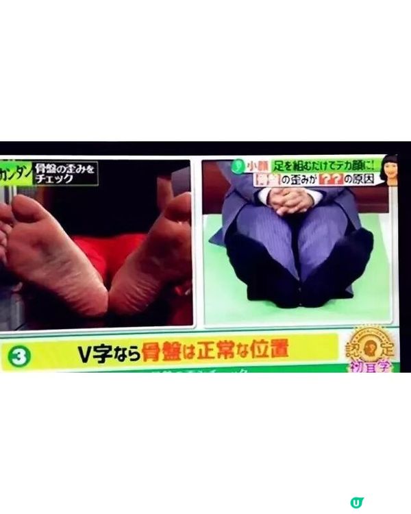 🚨日本節目揭3大變醜日常惡習！「1動作」會加深眼紋黑眼圈😱附盆骨傾斜自測