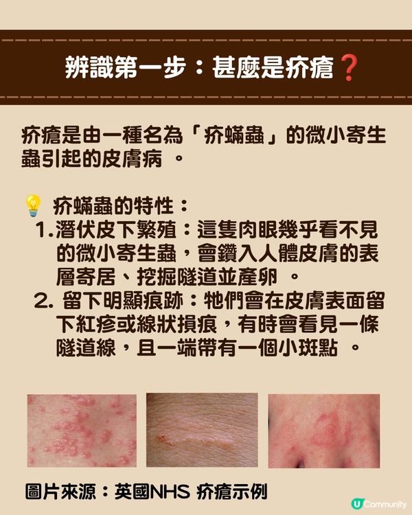 深圳現「疥瘡」感染個案🚨潛伏期無病徵照樣傳播！兩步辨識+治療消毒指南