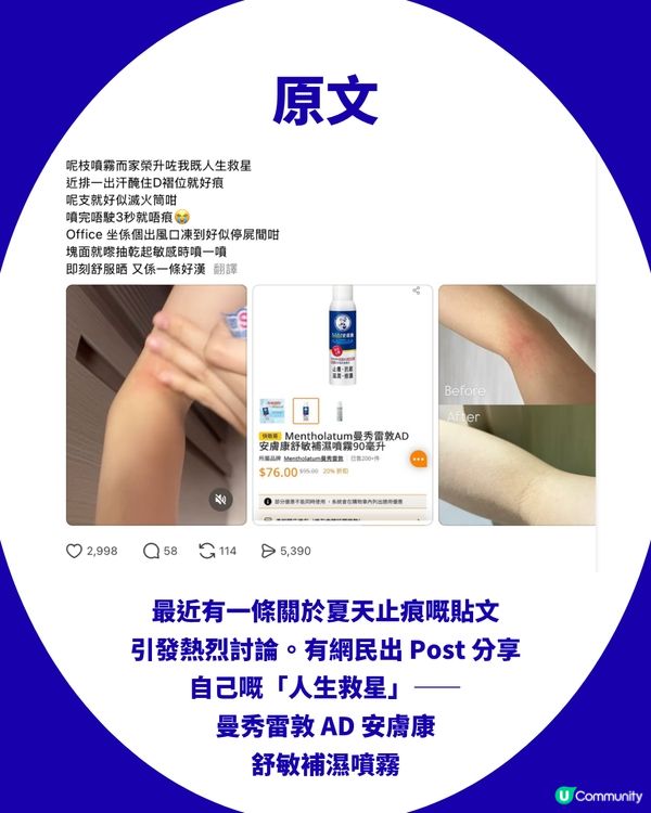 網民激推曼秀雷敦AD止痕噴霧！被封「皮膚滅火筒」！濕疹/敏感都用得！網民：人生救星                                                    