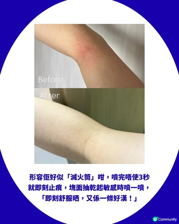 網民激推曼秀雷敦AD止痕噴霧！被封「皮膚滅火筒」！濕疹/敏感都用得！網民：人生救星                                                    