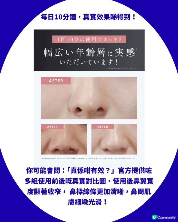 日本妹瘋搶「美鼻神器」！每日夾10分鐘拯救肉鼻翼／塌鼻樑？附真實對比圖