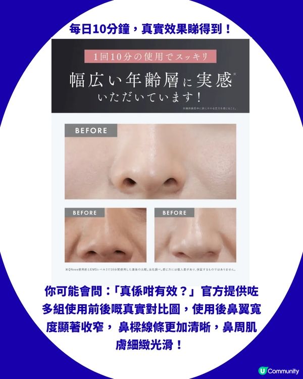 日本妹瘋搶「美鼻神器」！每日夾10分鐘拯救肉鼻翼／塌鼻樑？附真實對比圖