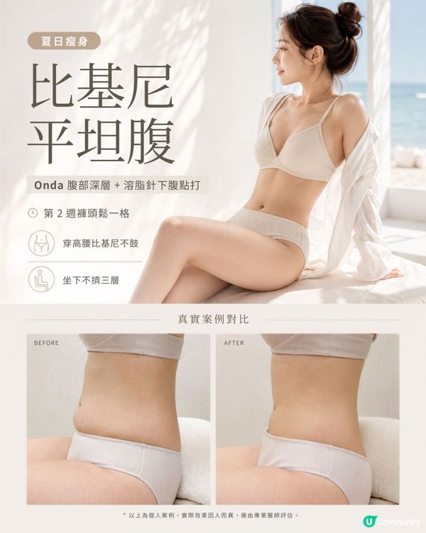夏日瘦身殺！雙醫美靚到爆 💉✨