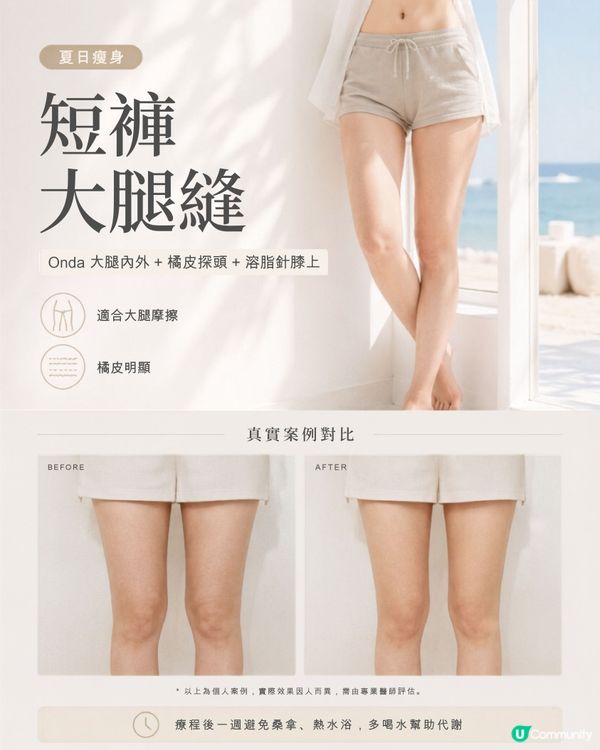 夏日瘦身殺！雙醫美靚到爆 💉✨