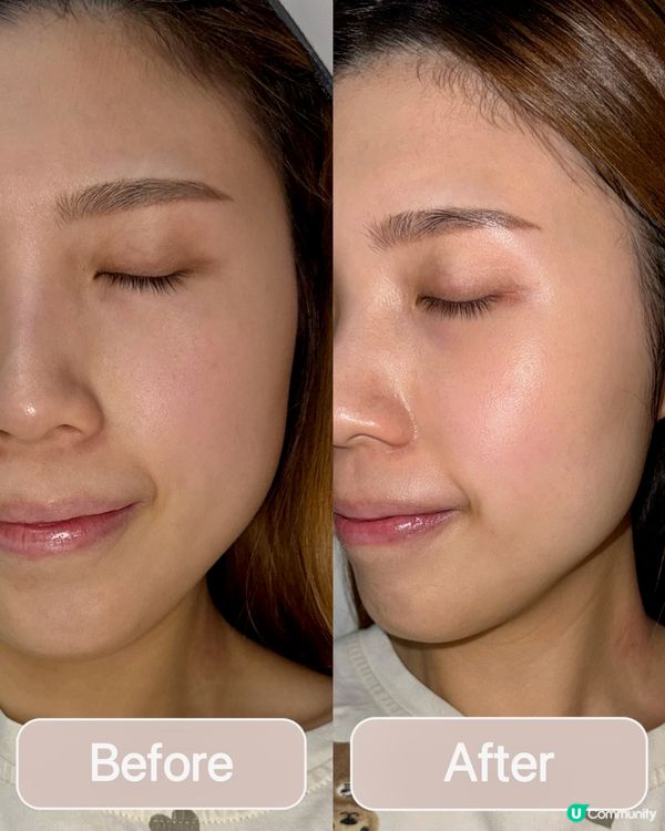 瑞士護膚品品牌Rekyle 貴婦級treatment💖