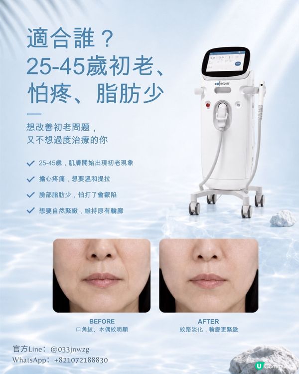 瘦面必睇！ SOS 💕
