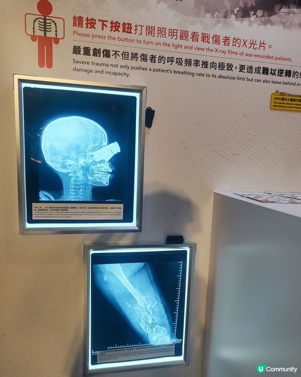  🩺又一城無國界醫生展覽🩻🚑送出免費手提風扇💉