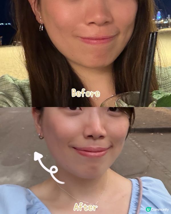 方便家用美容儀🥰 一次過滿足妳多個願望😍
