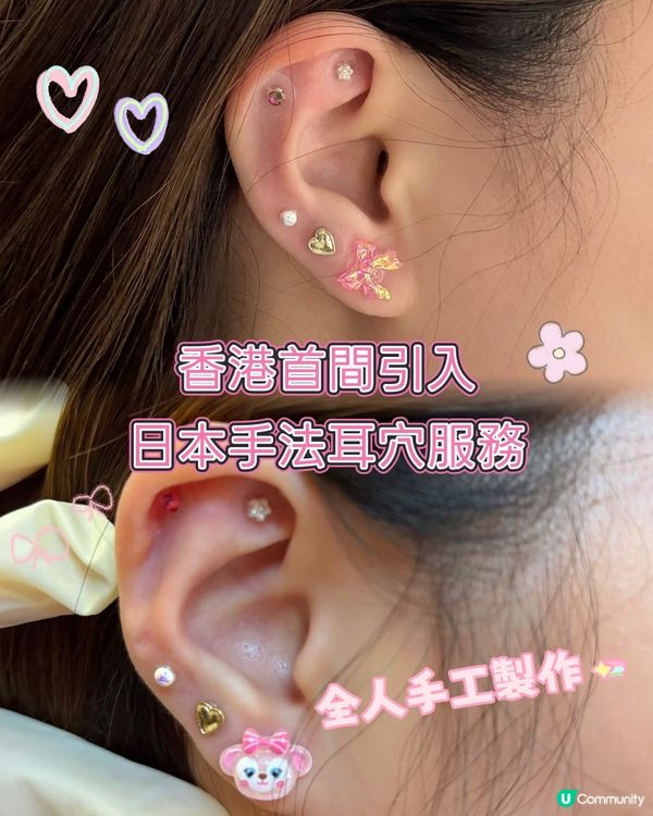香港首間引入日本手法耳穴服務❤️